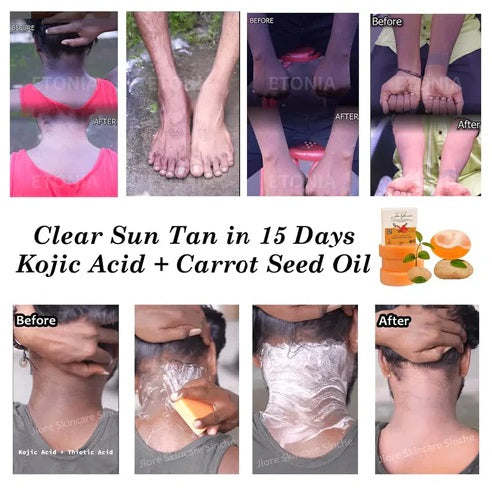 𝗚𝗹𝗼𝘄𝗣𝘂𝗿𝗲™ - 𝗞𝗼𝗷𝗶𝗲-𝗦𝗮𝗻 𝗦𝗸𝗶𝗻 𝗟𝗶𝗴𝗵𝘁𝗲𝗻𝗶𝗻𝗴 𝗦𝗼𝗮𝗽 ✨🧼