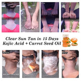 𝗚𝗹𝗼𝘄𝗣𝘂𝗿𝗲™ - 𝗞𝗼𝗷𝗶𝗲-𝗦𝗮𝗻 𝗦𝗸𝗶𝗻 𝗟𝗶𝗴𝗵𝘁𝗲𝗻𝗶𝗻𝗴 𝗦𝗼𝗮𝗽 ✨🧼