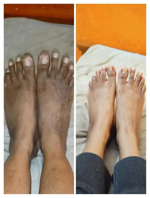 𝗚𝗹𝗼𝘄𝗣𝘂𝗿𝗲™ - 𝗞𝗼𝗷𝗶𝗲-𝗦𝗮𝗻 𝗦𝗸𝗶𝗻 𝗟𝗶𝗴𝗵𝘁𝗲𝗻𝗶𝗻𝗴 𝗦𝗼𝗮𝗽 ✨🧼